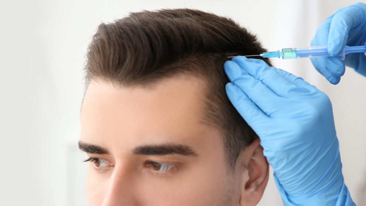 درمان های ریزش مو: مزوتراپی